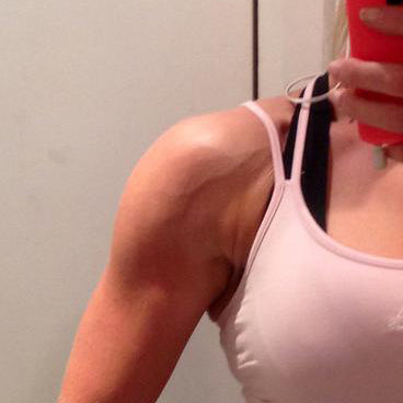 Shoulder vein